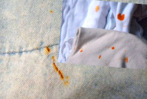 Ръжда по дрехите